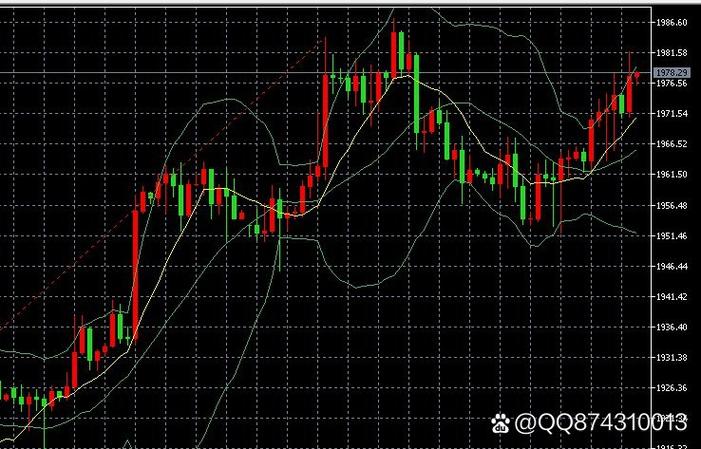 迈瑞医疗创始人成明和股份（迈瑞医疗徐航）